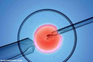 全球医疗